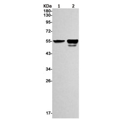 WARS1 rabbit monoclonal antibody