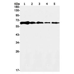 YY1 rabbit monoclonal antibody