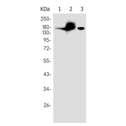 Ace rabbit monoclonal antibody