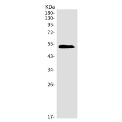 Agt rabbit monoclonal antibody