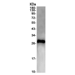 Calb1 rabbit monoclonal antibody