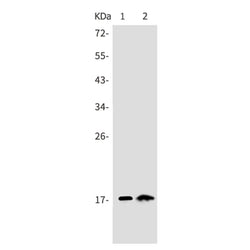 Cdkn2a rabbit monoclonal antibody