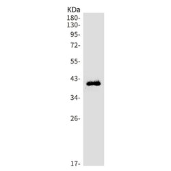 Pcgf6 rabbit monoclonal antibody