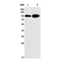 Thbd rabbit monoclonal antibody