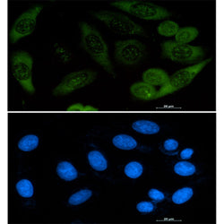 PFN1 rabbit monoclonal antibody