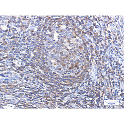 PFN1 rabbit monoclonal antibody