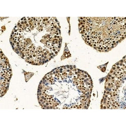Rabbit Polyclonal Antibody to UBXN7 - Biofargo - Biofargo - 