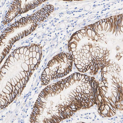 Pathology Antibodies