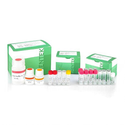 Virus DNA & RNA Extraction Kit SHENTEK®