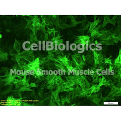 C57BL/6-GFP Mouse Primary Aortic Smooth Muscle Cells