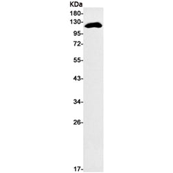 SPINK5 rabbit monoclonal antibody
