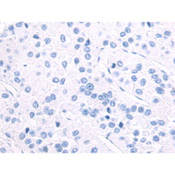 VEGFA rabbit polyclonal antibody