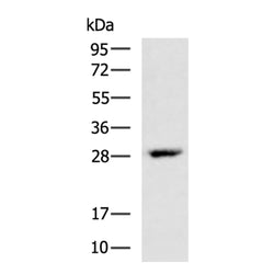 VEGFA rabbit polyclonal antibody