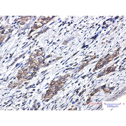 ZFYVE9 rabbit monoclonal antibody