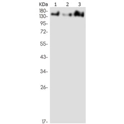 ZFYVE9 rabbit monoclonal antibody