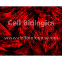 Aged Mouse Aortic Smooth Muscle Cells