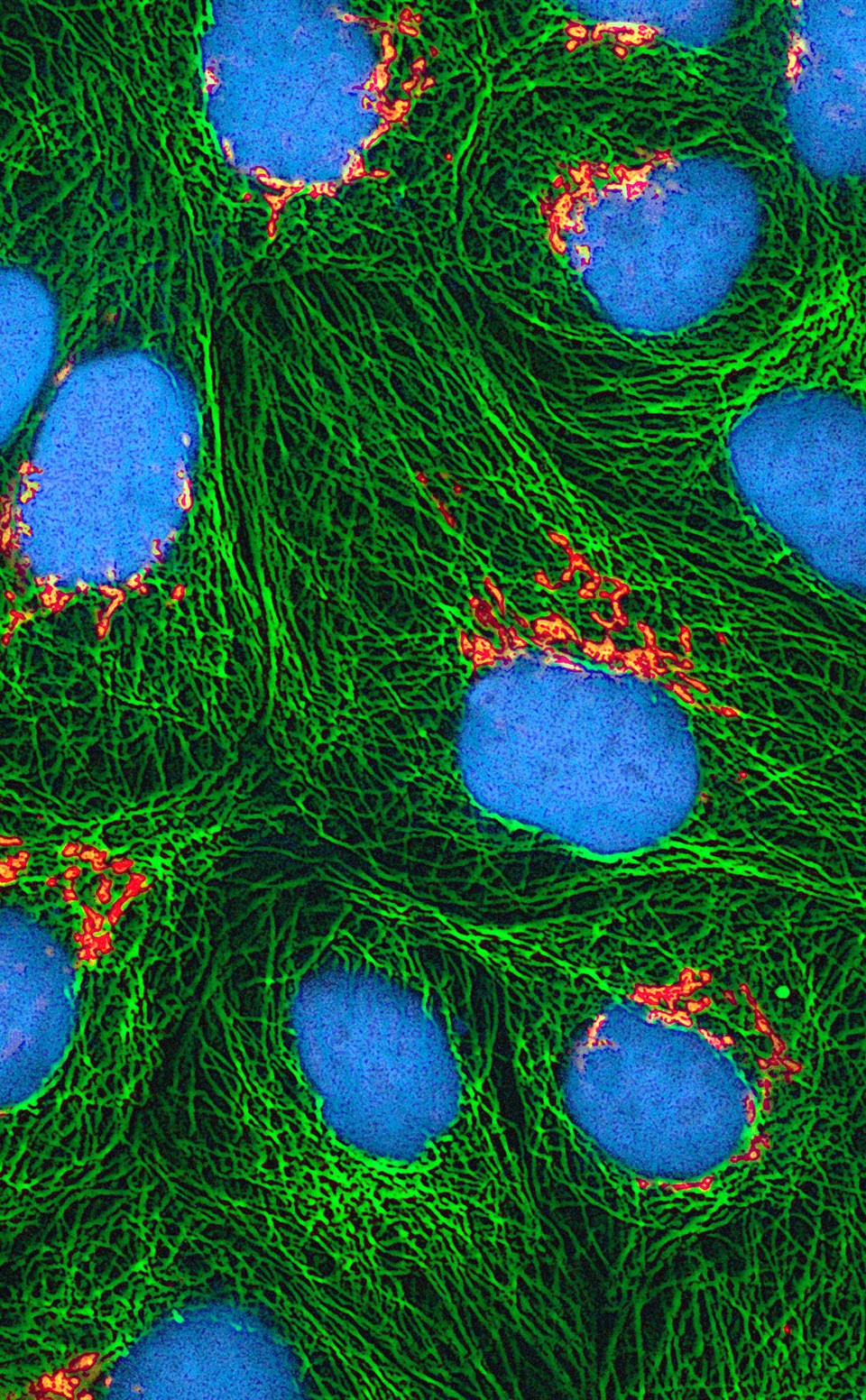 Fluorescence micrograph of cells showing green microtubules, blue nuclei, and orange fluorescent protein